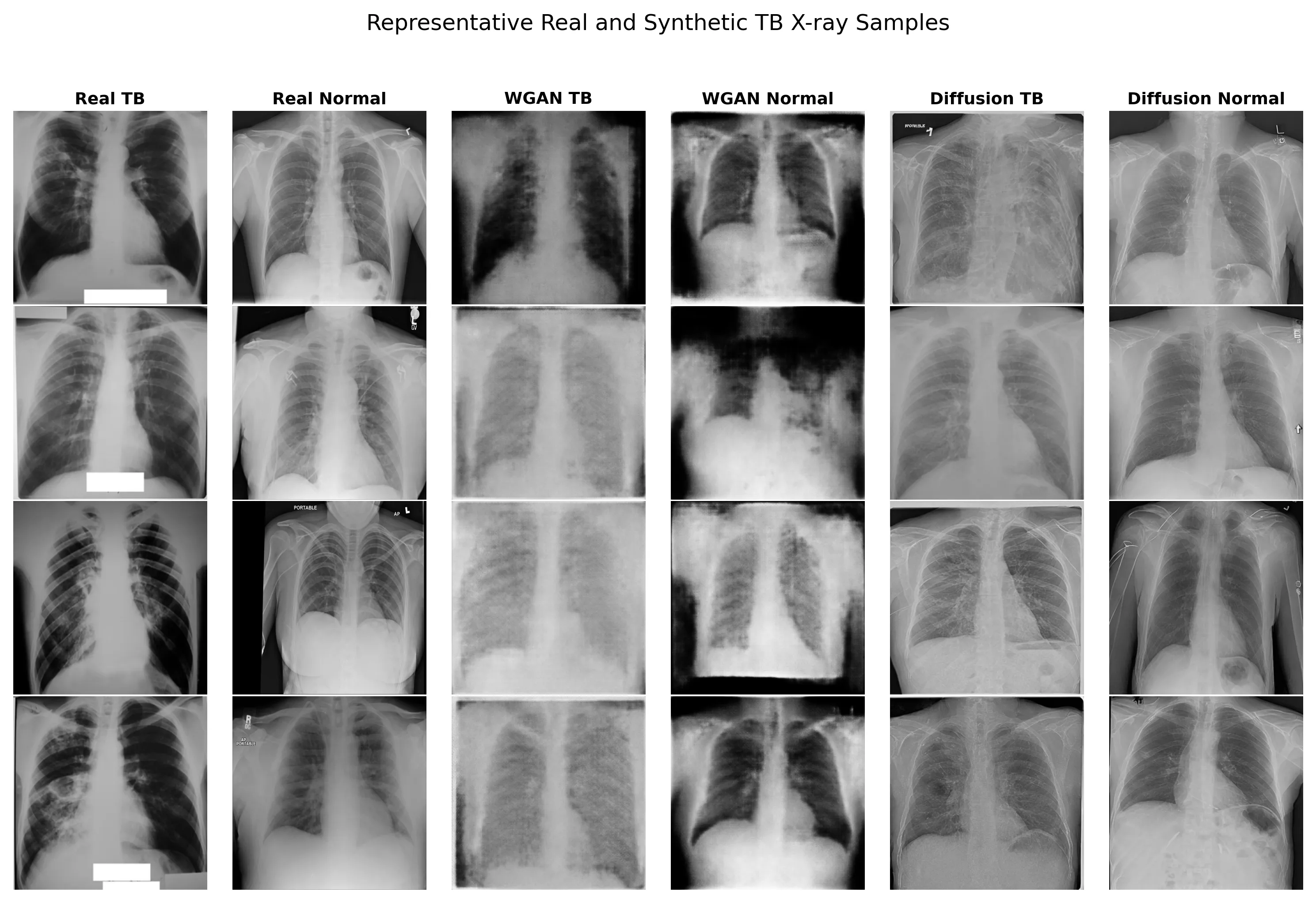 Chest X-ray segmentation figure.